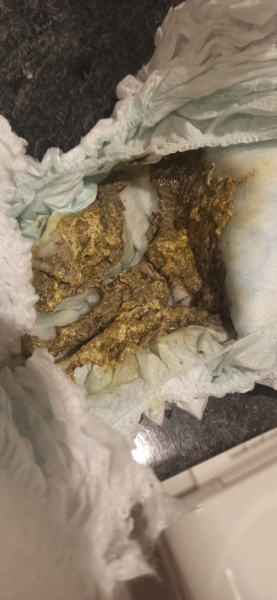 Baby diarrhea