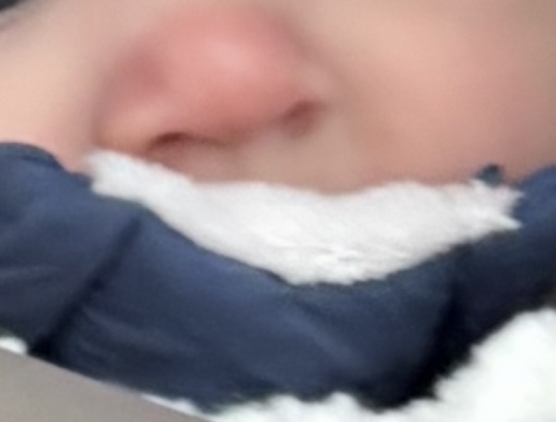 Baby nose has been red for over a week now. Is this normal?