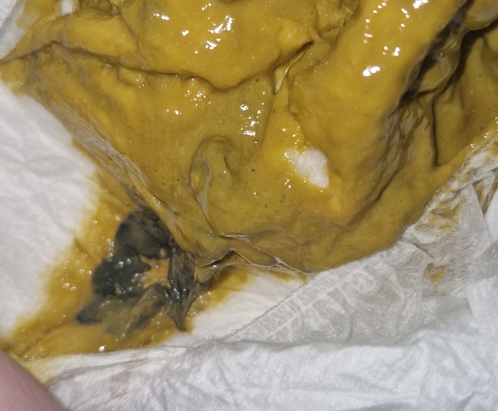 Abnormal baby poop *pics*