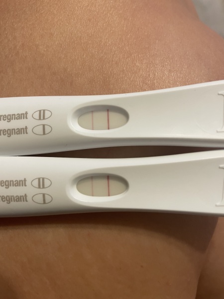 Light FRER for 9dp5dt?? Images included.
