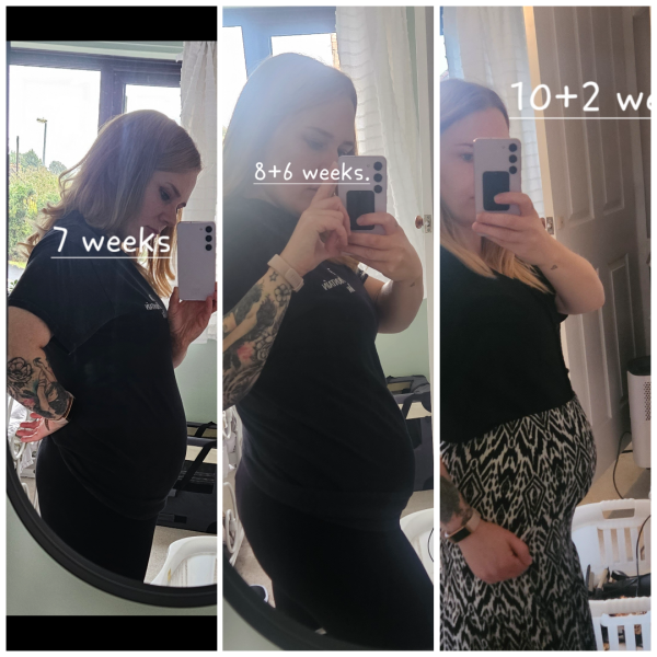 Anyone had a bump at 10 weeks, 2nd pregnancy?