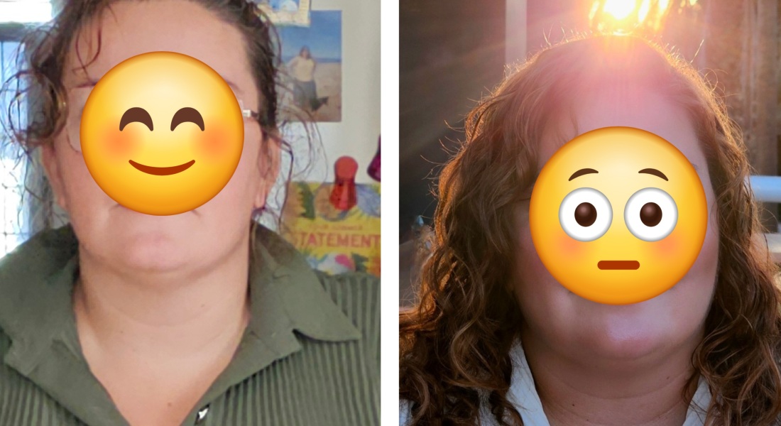 Mounjaro August Starters 6