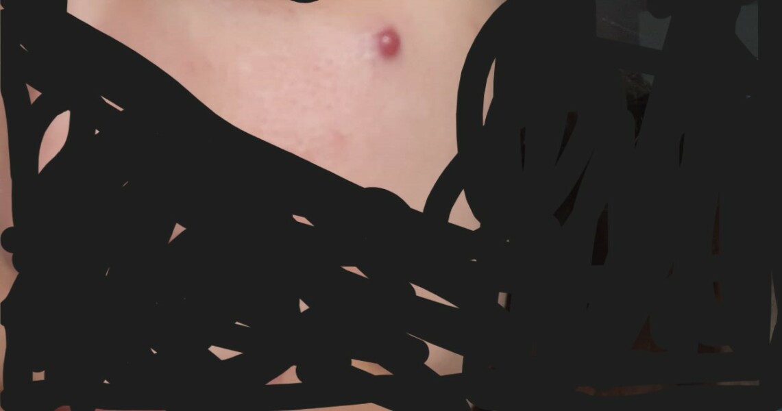 What is this on my face
