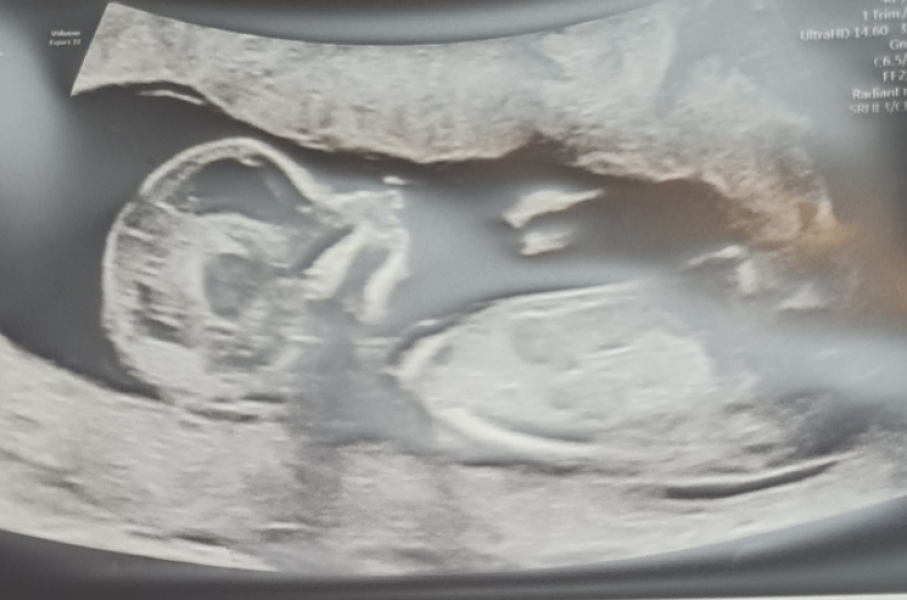 Boy or girl?