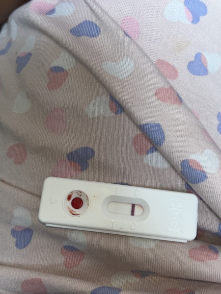 Hcg blood test