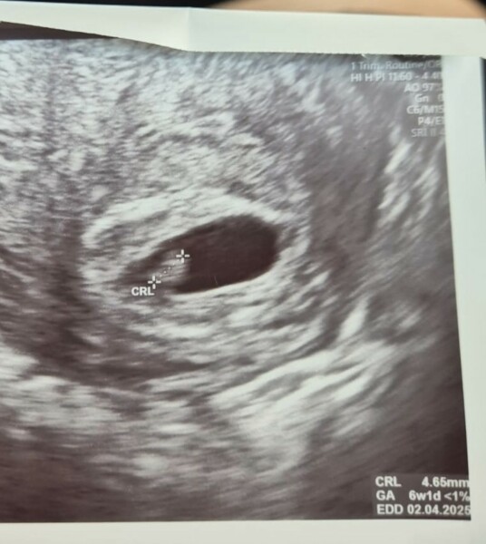 6week scan