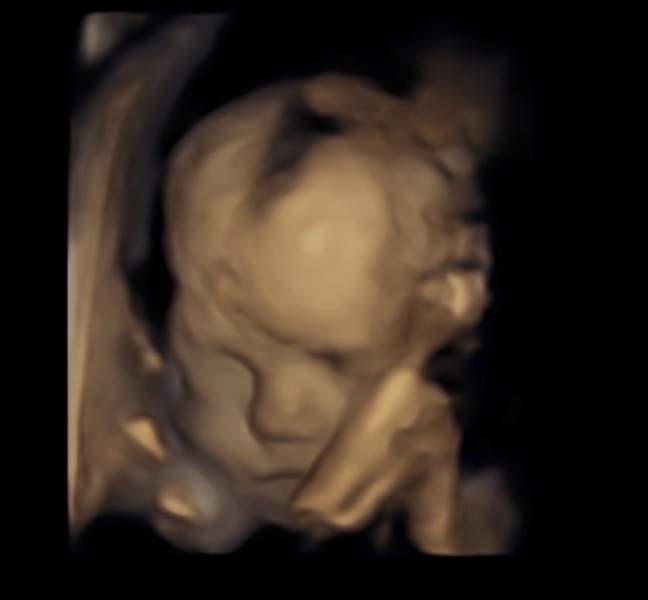 Due February 2025 - Thread 3