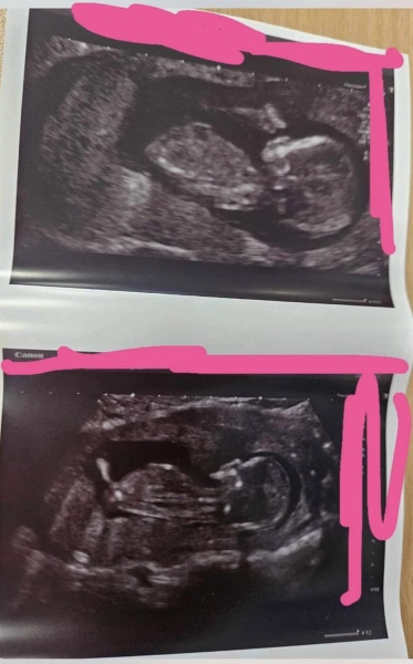 Gender guesses please!