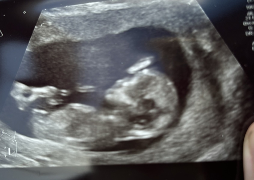 Any thoughts on boy or girl??