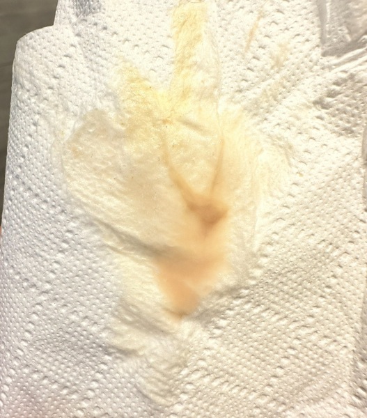 Implantation bleeding? (Graphic pic)