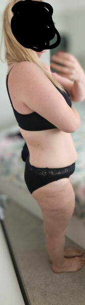I thought this was fat. I think it might be fat and loose skin. What do I do?
