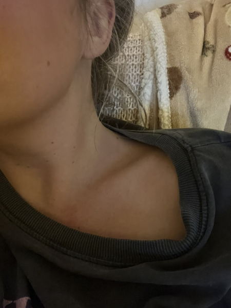 Mounjaro August Starters 6