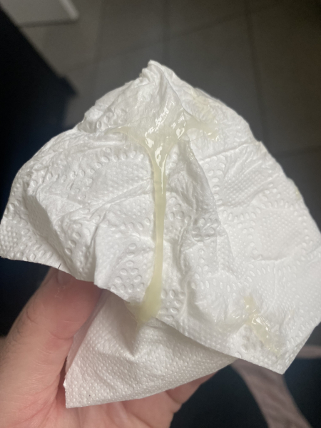 CM day before period due (TMI photo in comments)