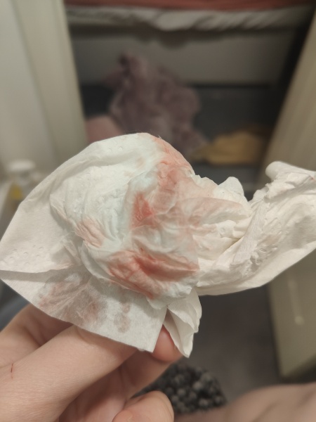 Could this be implantation bleeding?