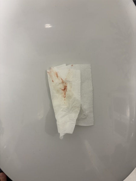 7and8dpo spotting