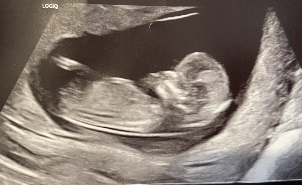 Boy or girl?