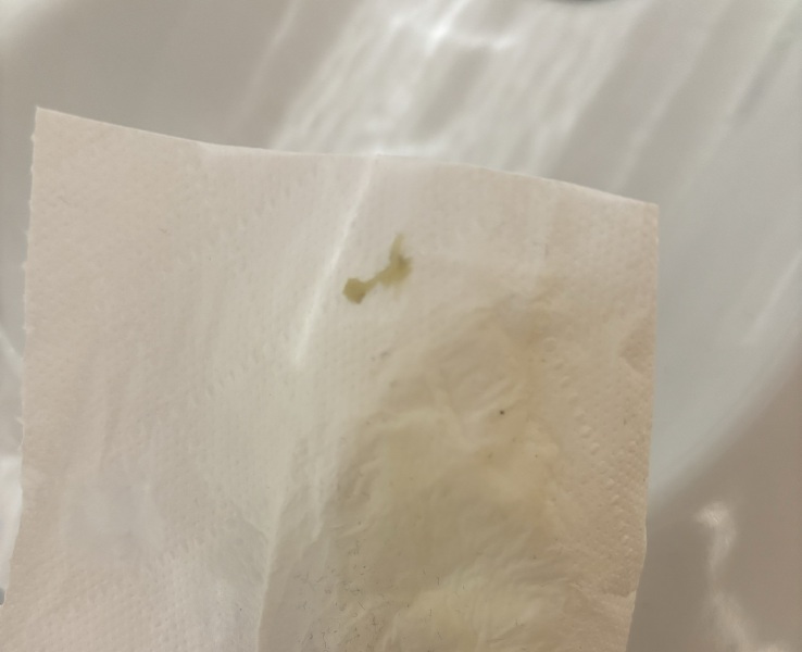 Discharge normal?