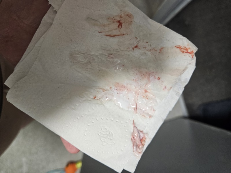 Blood 8 weeks.