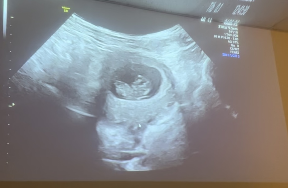 Any guesses boy or girl from my scan? Xx