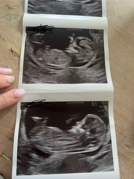 Are we having a boy or girl?