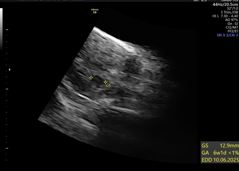 Early scan