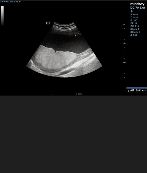 Amniotic fluid