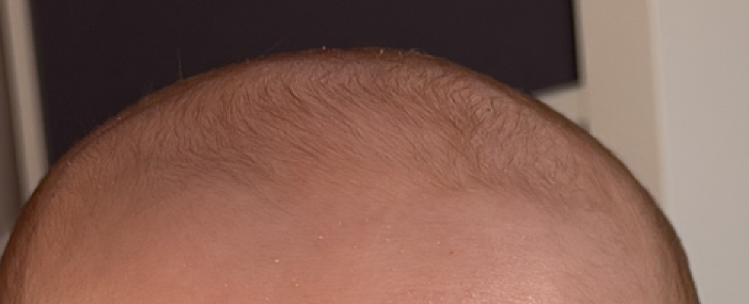 Baby hair growth?