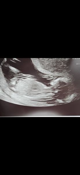 Boy or girl guesses? :)