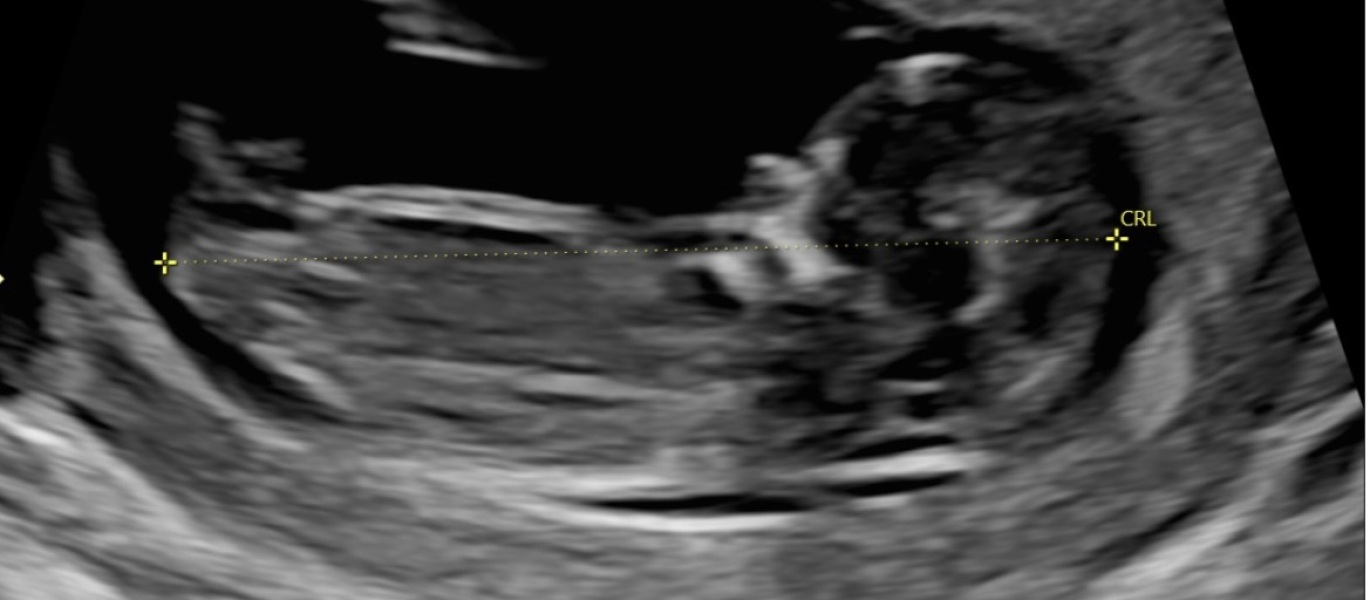Gender guess please