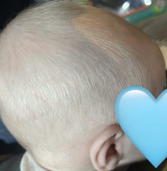 Will baby be ginger?