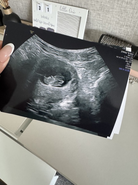 Any guesses boy or girl from my scan? Xx