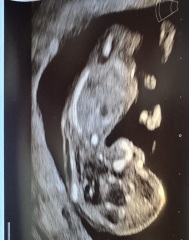 Gender guesses please!