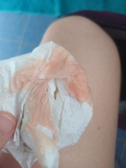 *** tmi*** bleeding at 11 weeks