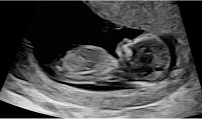 Gender guess please