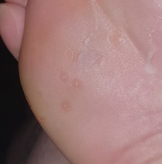 Any idea what these could be?! Pic included!