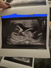 12+6 scan- for fun!