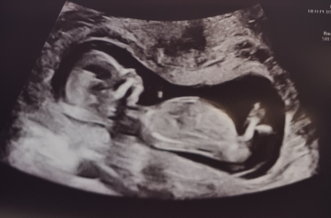 Boy or girl?