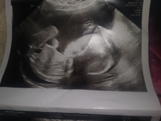 Gender prediction? ❤️