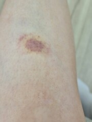 Would this worry you? (Pic)