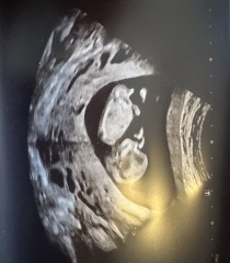 Gender guesses please!