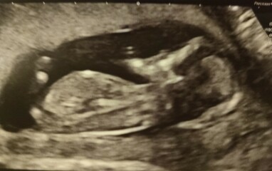 12 week nub theory guesses!!