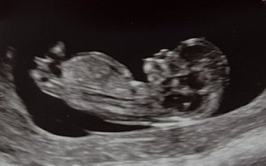 Nub Theory - Boy or Girl?