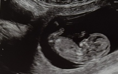 Nub Theory - Boy or Girl?