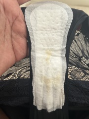 Is this normal discharge - 23 weeks