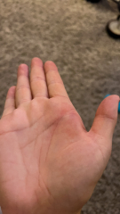 Does anyone know what happened to my hand?