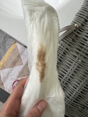 What’s this brown spotting mean?