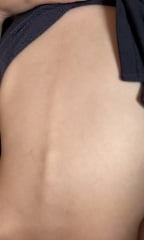 Toddlers spine shows a little