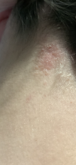 Skin issue. What is this ?