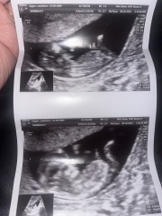Gender / nub predictions