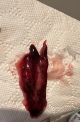 Am I having another miscarriage?